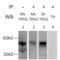 Tryptophan Hydroxylase 2 antibody, PA1-778, Invitrogen Antibodies, Immunoprecipitation image 