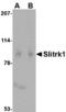 SLIT And NTRK Like Family Member 1 antibody, TA306521, Origene, Western Blot image 