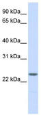 Nucleophosmin/Nucleoplasmin 2 antibody, TA344382, Origene, Western Blot image 