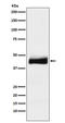 Orosomucoid 2 antibody, M04684, Boster Biological Technology, Western Blot image 