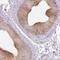 Vacuolar Protein Sorting 25 Homolog antibody, PA5-63427, Invitrogen Antibodies, Immunohistochemistry paraffin image 