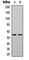 Serum/Glucocorticoid Regulated Kinase 1 antibody, abx133031, Abbexa, Western Blot image 