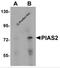 E3 SUMO-protein ligase PIAS2 antibody, 5743, ProSci Inc, Western Blot image 