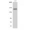 RAB3 GTPase Activating Non-Catalytic Protein Subunit 2 antibody, LS-C385692, Lifespan Biosciences, Western Blot image 