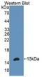 B And T Lymphocyte Associated antibody, LS-C374205, Lifespan Biosciences, Western Blot image 