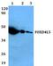 Forkhead Box D4 Like 5 antibody, A19272, Boster Biological Technology, Western Blot image 