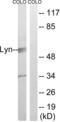 LYN Proto-Oncogene, Src Family Tyrosine Kinase antibody, LS-C117568, Lifespan Biosciences, Western Blot image 
