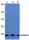 Retinoic Acid Receptor Responder 2 antibody, PA5-75917, Invitrogen Antibodies, Western Blot image 