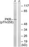 Eukaryotic Translation Initiation Factor 2 Alpha Kinase 2 antibody, PA5-39751, Invitrogen Antibodies, Western Blot image 