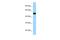 Folylpolyglutamate Synthase antibody, A02836, Boster Biological Technology, Western Blot image 