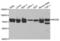 NDC80 Kinetochore Complex Component antibody, abx004145, Abbexa, Western Blot image 