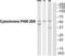 Cytochrome P450 Family 2 Subfamily D Member 6 antibody, abx015137, Abbexa, Western Blot image 