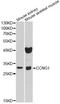 Cyclin G1 antibody, STJ27245, St John