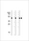 DExD-Box Helicase 39B antibody, PA5-72565, Invitrogen Antibodies, Western Blot image 