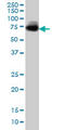 Alpha-1,3-Mannosyl-Glycoprotein 4-Beta-N-Acetylglucosaminyltransferase A antibody, LS-C133686, Lifespan Biosciences, Western Blot image 