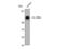 Interleukin 20 Receptor Subunit Alpha antibody, STJ93690, St John