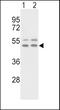 Vitronectin antibody, 62-933, ProSci, Western Blot image 