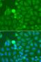 Interleukin 1 Receptor Associated Kinase 2 antibody, GTX33273, GeneTex, Immunocytochemistry image 