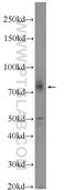 ATP Binding Cassette Subfamily D Member 2 antibody, 18179-1-AP, Proteintech Group, Western Blot image 
