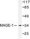 MAGE Family Member A1 antibody, LS-C176108, Lifespan Biosciences, Western Blot image 