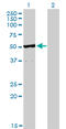 TNF Receptor Associated Factor 4 antibody, LS-C133597, Lifespan Biosciences, Western Blot image 