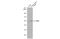 Lysine Acetyltransferase 5 antibody, GTX112198, GeneTex, Western Blot image 