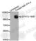 Signal Transducer And Activator Of Transcription 2 antibody, AP0284, ABclonal Technology, Western Blot image 