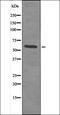 SMAD2 antibody, orb335728, Biorbyt, Western Blot image 