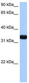 GTPase, IMAP Family Member 1 antibody, TA342102, Origene, Western Blot image 