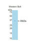 Protein Kinase C Beta antibody, LS-C301160, Lifespan Biosciences, Western Blot image 