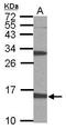 6-Pyruvoyltetrahydropterin Synthase antibody, TA308040, Origene, Western Blot image 