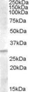 Insulin Like Growth Factor Binding Protein 4 antibody, PA5-18928, Invitrogen Antibodies, Western Blot image 