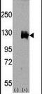 Transient Receptor Potential Cation Channel Subfamily M Member 8 antibody, PA5-15507, Invitrogen Antibodies, Western Blot image 