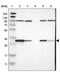 Cytochrome B5 Reductase 1 antibody, PA5-53128, Invitrogen Antibodies, Western Blot image 