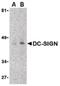 CD209 Molecule antibody, LS-B14746, Lifespan Biosciences, Western Blot image 