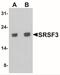 Serine And Arginine Rich Splicing Factor 3 antibody, NBP2-41316, Novus Biologicals, Western Blot image 