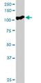 Scm Like With Four Mbt Domains 1 antibody, H00051460-D01P, Novus Biologicals, Western Blot image 