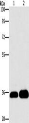 Lin-28 Homolog B antibody, TA350898, Origene, Western Blot image 