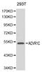 Activin A Receptor Type 1C antibody, LS-C192242, Lifespan Biosciences, Western Blot image 