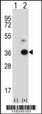 Angiopoietin Like 7 antibody, 56-561, ProSci, Western Blot image 