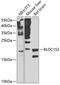 Biogenesis Of Lysosomal Organelles Complex 1 Subunit 2 antibody, 23-347, ProSci, Western Blot image 