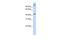 AFG3 Like Matrix AAA Peptidase Subunit 2 antibody, PA5-42924, Invitrogen Antibodies, Western Blot image 