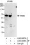 TRNA Methyltransferase 6 antibody, A303-007A, Bethyl Labs, Immunoprecipitation image 