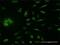 Ribosomal Protein S6 Kinase A5 antibody, H00009252-M11, Novus Biologicals, Immunocytochemistry image 