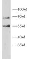 Itchy E3 Ubiquitin Protein Ligase antibody, FNab10328, FineTest, Western Blot image 