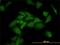 Ankyrin Repeat Family A Member 2 antibody, H00057763-M01, Novus Biologicals, Immunocytochemistry image 