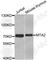 Metastasis Associated 1 Family Member 2 antibody, A2243, ABclonal Technology, Western Blot image 