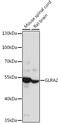 Glycine Receptor Alpha 2 antibody, 16-172, ProSci, Western Blot image 