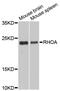 Ras Homolog Family Member A antibody, MBS125127, MyBioSource, Western Blot image 