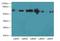 Polo Like Kinase 1 antibody, LS-C397140, Lifespan Biosciences, Western Blot image 